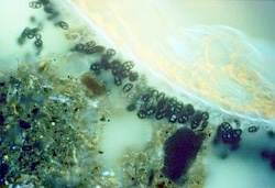 This shows a microscopic view of bacteria in a rotting root. Image credit: Karl Ritz